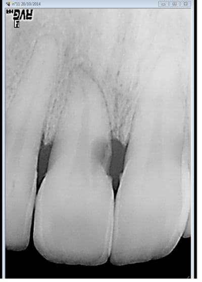 11 yclmct - Eugenol