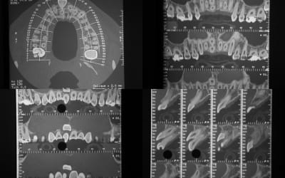 11bis1 szvnqs - Eugenol