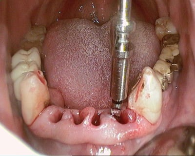 12 20120602 094040   copie a9f2fp - Eugenol
