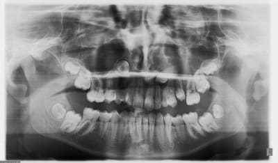 12032010 hyd5lq - Eugenol