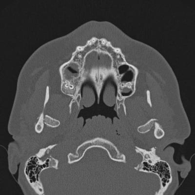 137 idlict - Eugenol