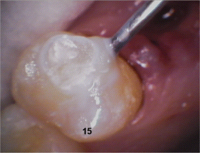 15 09 dli9fg - Eugenol