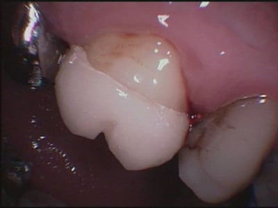 16 idem nhveqw - Eugenol