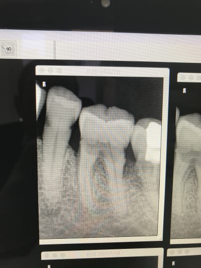 1bcac81d 82b4 4f17 b8c2 cacff4b04034 ejhmph - Eugenol