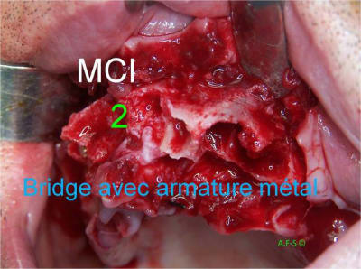 1 2 3 mci 003 u8mkus - Eugenol