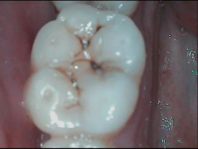 1 h75zgy - Eugenol