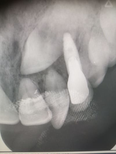 1cehfyo452d8vb4e4rhx349l17tv - Eugenol