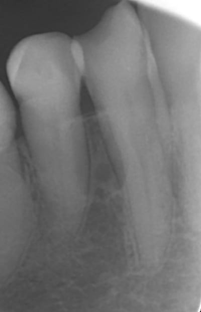 20 06 15 rg9im9 - Eugenol