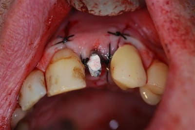 2007 01 06 028 kiaed3 - Eugenol