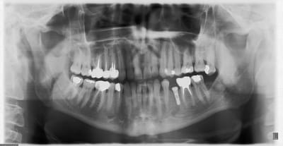 2007 wtno4i - Eugenol