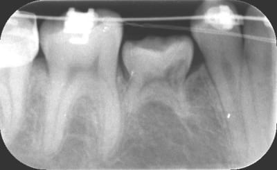 2007 zrmm6h - Eugenol
