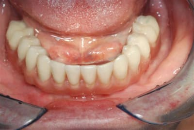 2008 11 14 017 q34xeg - Eugenol