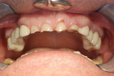 2009 01 16 014 jxho95 - Eugenol