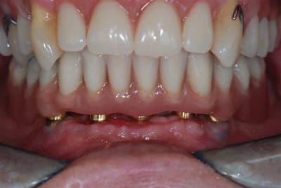 2009 07 12 002 enqn7n - Eugenol