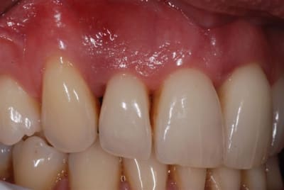 2010 03 09 002 wpo2gh - Eugenol