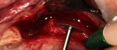 2010 05 28 0286 wbmbvy - Eugenol
