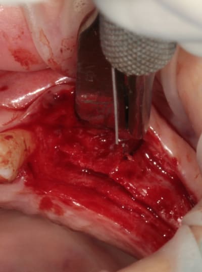 2010 05 28 0331w z95e4q - Eugenol