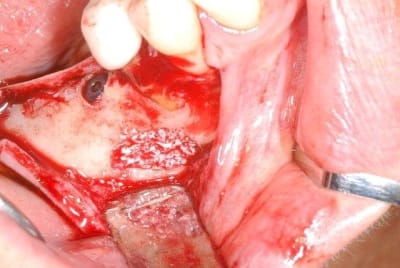 2011 07 01b 007 ojectk - Eugenol