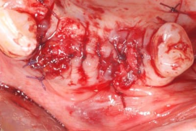 2011 09 15 012 iov7kf - Eugenol