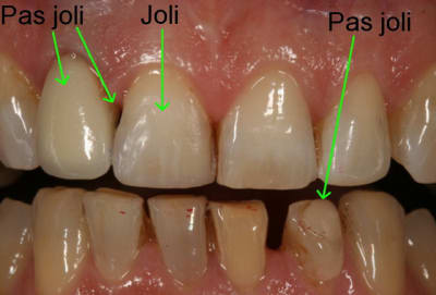 2011 10 29 093523 juopqm - Eugenol