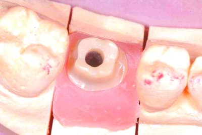 2012 02 07 038 nbfid7 - Eugenol