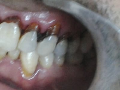 2012 05 29 13.46 - Eugenol