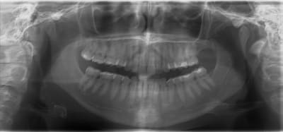 20120208 w9ibur - Eugenol