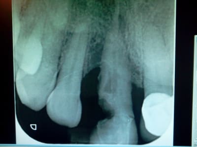 2013 03 26 20.14 - Eugenol