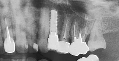 2013  2  zd3avz - Eugenol