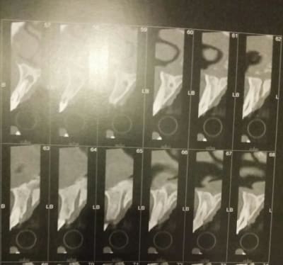 2014 04 01 20.53 - Eugenol