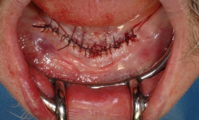 2015 11 5 8 sf8zad - Eugenol