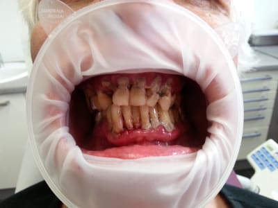 20180426 111537 drqjmy - Eugenol