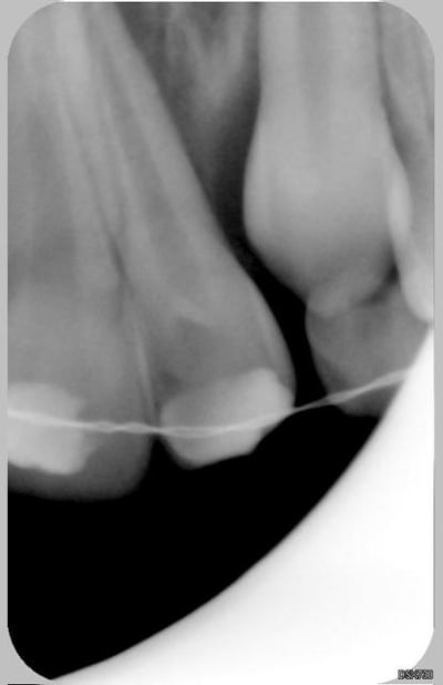 22 21 16 04 2007 ozumpl - Eugenol