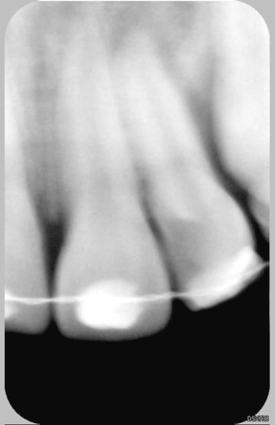 22 21 19 4 2006 hjrw8p - Eugenol