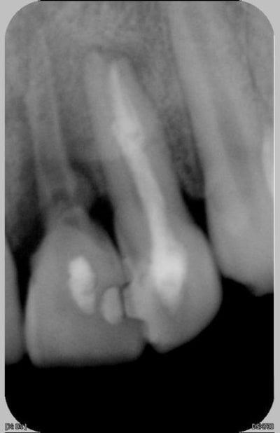 22 21 27 06 2007 gdq9x5 - Eugenol