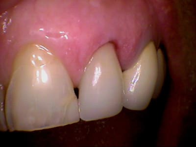 22 maquillage et polissage final fn5dab - Eugenol