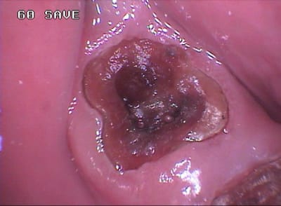 251 bwt8lk - Eugenol