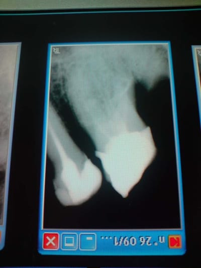 25 et 26 zwegyz - Eugenol