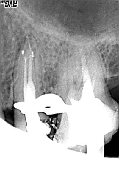 25 fini u7wvly - Eugenol