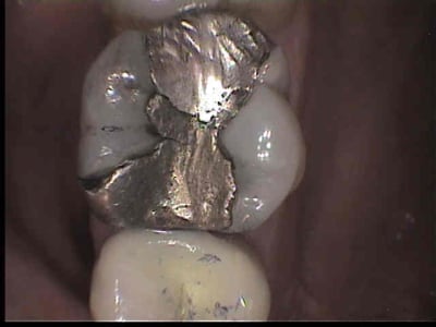 26 cam ddhgai - Eugenol