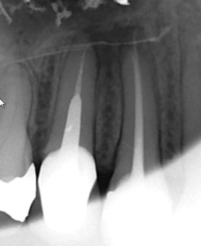 2   29042014 fq11bt - Eugenol