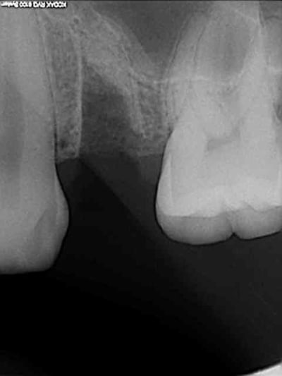 2 extraction nll6lg - Eugenol