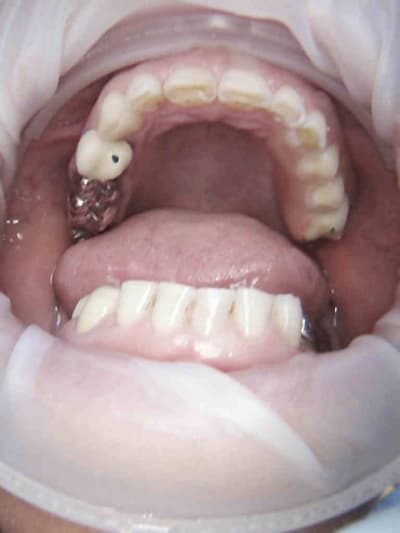 2 feygra - Eugenol