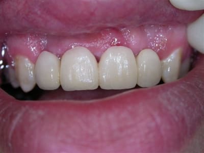 2 tm3qaz - Eugenol