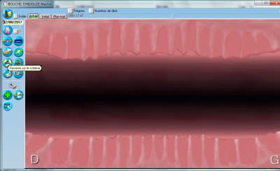 2complets julie visu bouche qman0v - Eugenol
