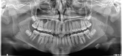 2ozpxtnvb5zjfilpwj6kl8uzbkyz - Eugenol