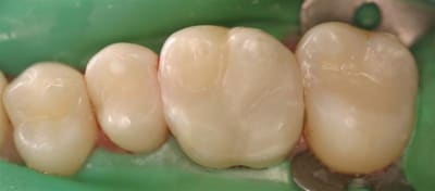 3 q1 composite apr s bnh2zm - Eugenol