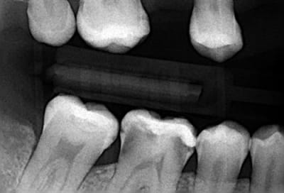 30 19618 mid lkgqnw - Eugenol