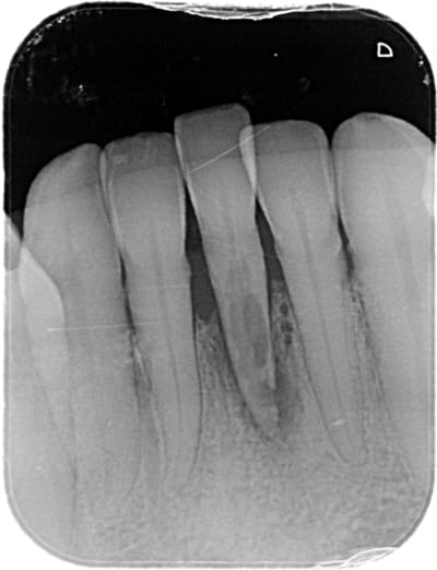 31 pstbam - Eugenol