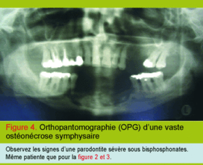 32297 4 jxqasu - Eugenol
